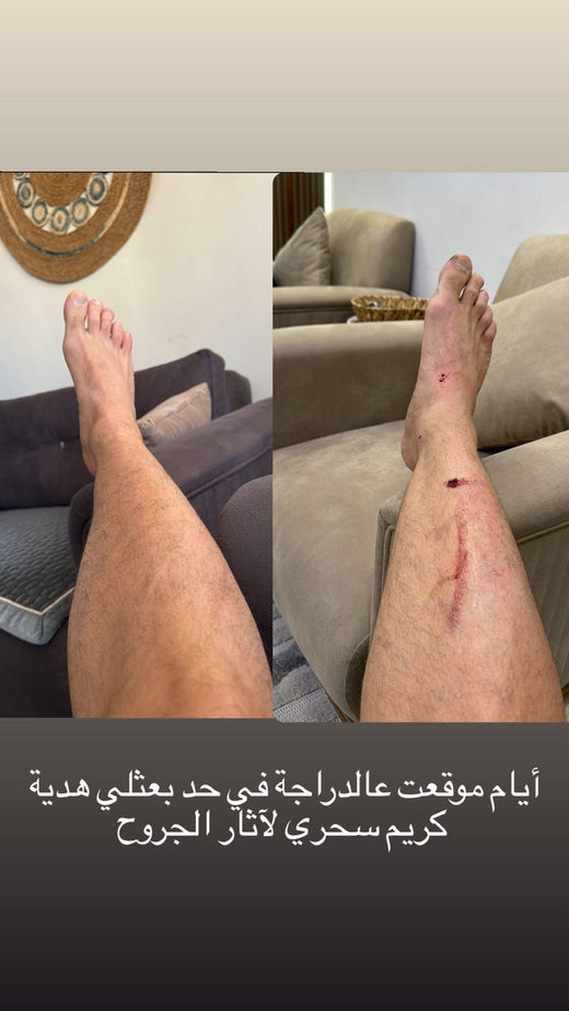 تامر بسيسو